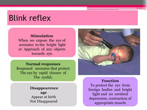 New born reflexes | PPTX