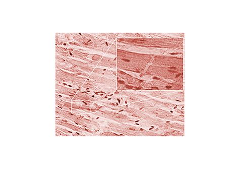 Voluntary and Involuntary Muscles: Definition, Differences & Examples ...