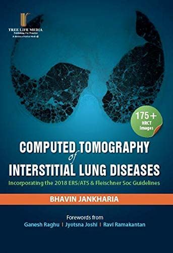 Buy Computed Tomography of Interstitial Lung Diseases Book Online at ...