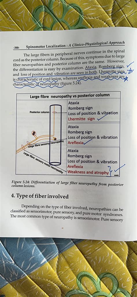 Buy Spinomotor Localization: A Clinico-Physiological Approach, 1st ...