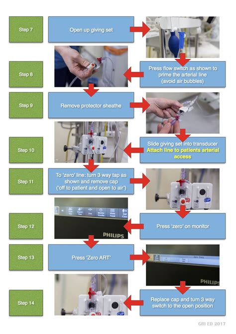 Steps To Zero Arterial Line