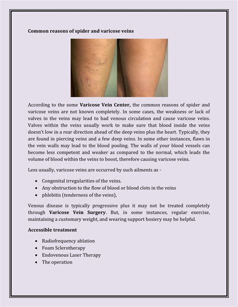 PPT - What are varicose veins PowerPoint Presentation, free download - ID:8126175