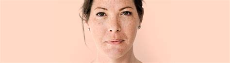 How To Reduce Melanin Production from Skin in 3 Months?
