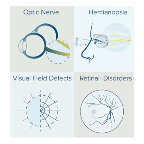 Neuro-Ophthalmology