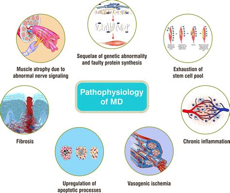 Muscular Dystrophy - Cell Therapy
