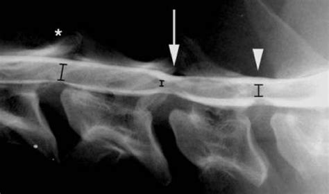 What Is Wobblers Disease In Dogs