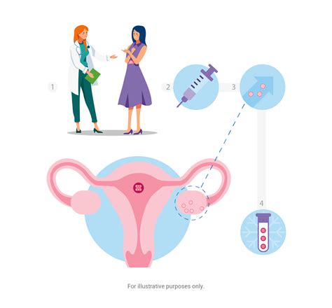 Ivf Process Step By Step Egg Retrieval