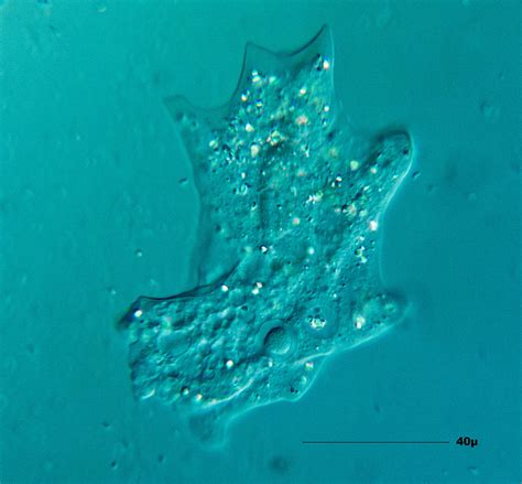 How Does Amoeba Reproduce? - (Reproduction in Amoeba)