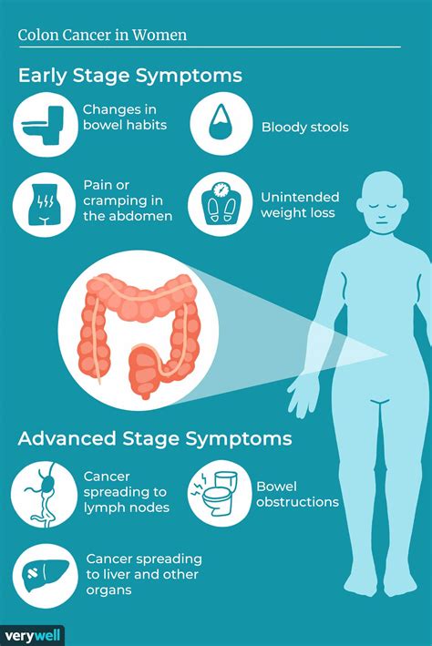 Colon Cancer In Women