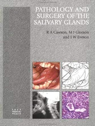 Buy Pathology and Surgery of the Salivary Glands Book Online at Low ...