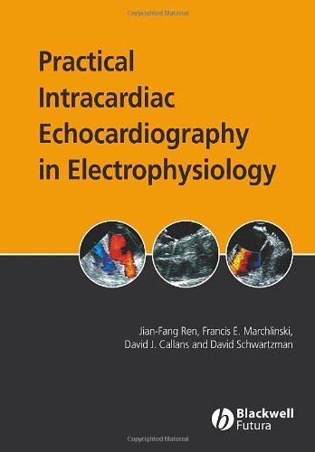 Practical Intracardiac Echocardiography in Electrophysiology eBook ...