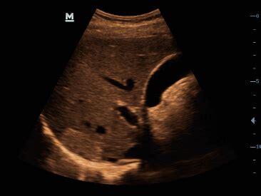 DP-50Exp - Ultrasound System - Mindray India