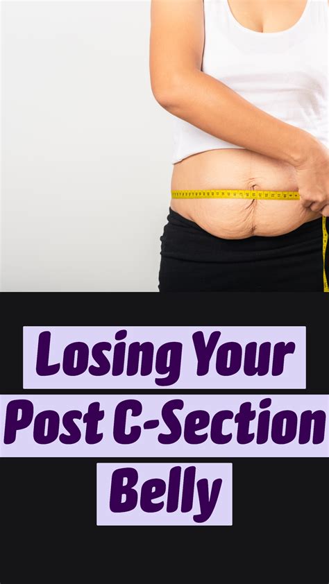 Losing your post c section belly – Artofit