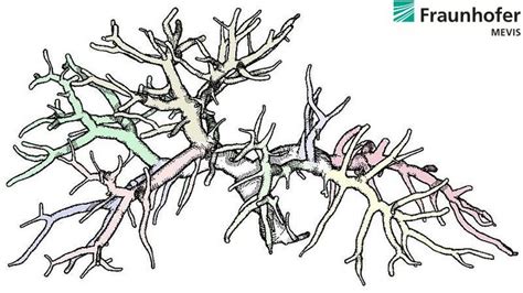 Image result for MeVisLab Connectors Triangle