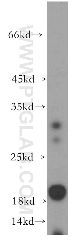 ARF6-Specific antibody (20225-1-AP) | Proteintech
