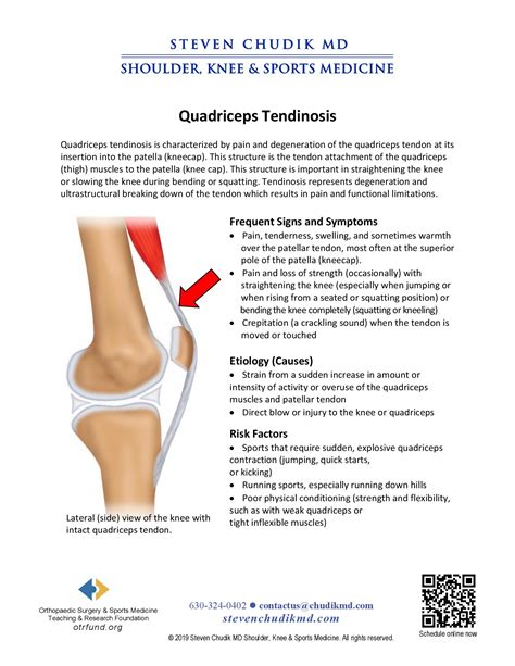 Quadriceps Tendinopathy 4 Essential Exercises For Effective Quadriceps