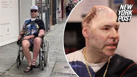 Image result for Rapper Loses Ruby