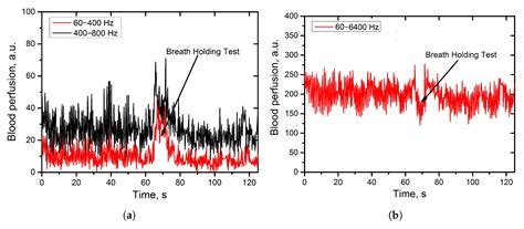 Laser Doppler Spectrum Analysis Based on Calculation of Cumulative Sums ...