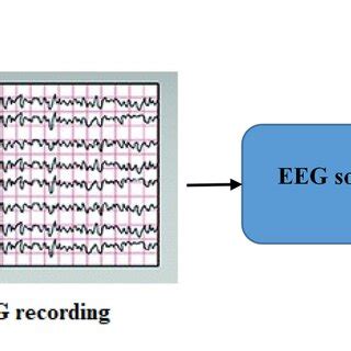 Image result for EEG Source Localization