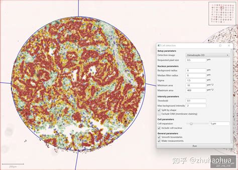 QuPath Plugins 的图像结果