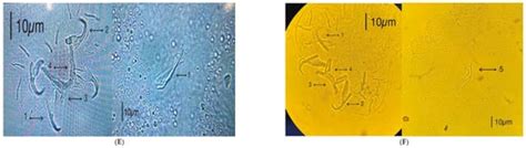 Garlic Powder Evaluation as Feed Additive on Nile Tilapia (Oreochromis ...