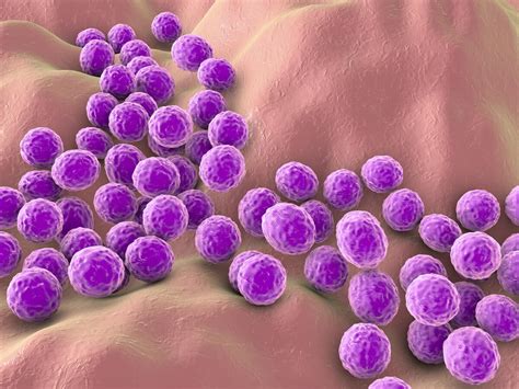 Image result for Staphylococcus Saprophyticus Infection