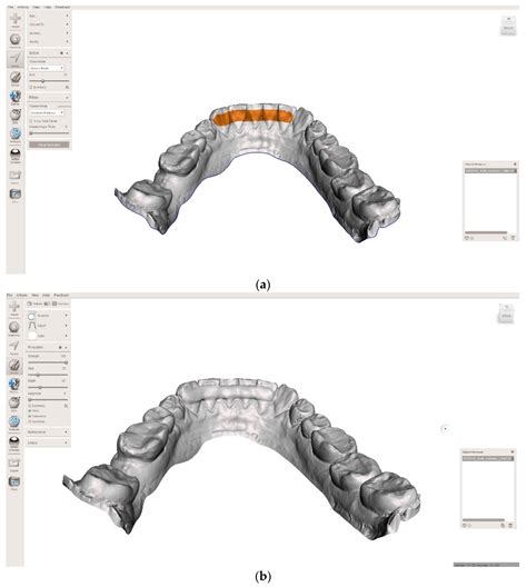 Mechanical Properties of 3D Printed Orthodontic Retainers