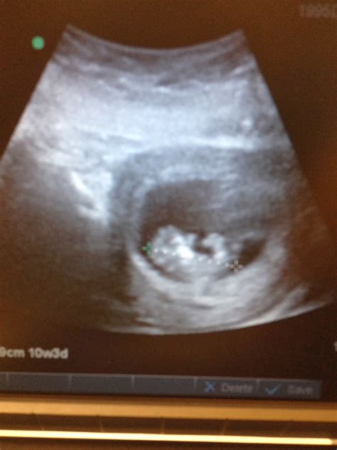 Image result for Alien Ultrasound