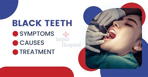 Image result for Stumpy Black Teeth