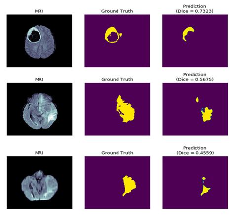 Diagnostics | Special Issue : Artificial Intelligence in Diagnostics