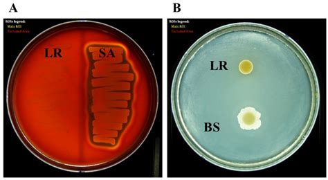 Isolation and Identification of Limosilactobacillus reuteri PSC102 and ...