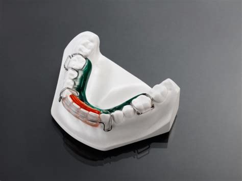 Image result for Compression Spring Retainer