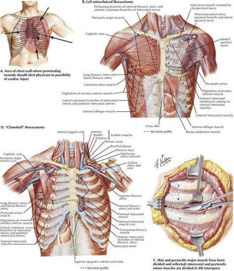 Image result for Clamshell Thoracotomy