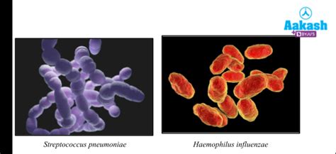 Human Diseases Types, Symptoms, Transmission & Treatment | AESL