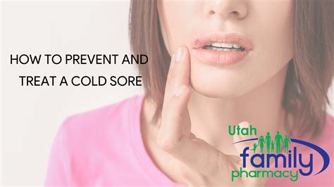 How To Prevent and Treat a Cold Sore - Utah Family Pharmacy