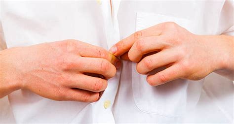 Image result for Alien Hand Syndrome Documentary