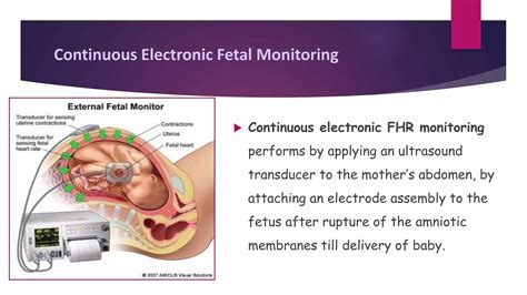 Types of Fetal monitoring | PPTX