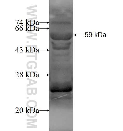FOXG1 Fusion Protein Ag3426 | Proteintech