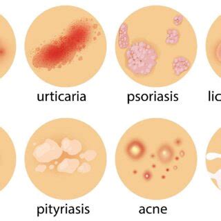Image result for Different Types of Skin Conditions