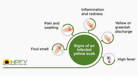 Scab After Wound Healing at Stan Denham blog
