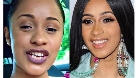 Cardi B Teeth: The Science and Culture of Her Iconic Smile