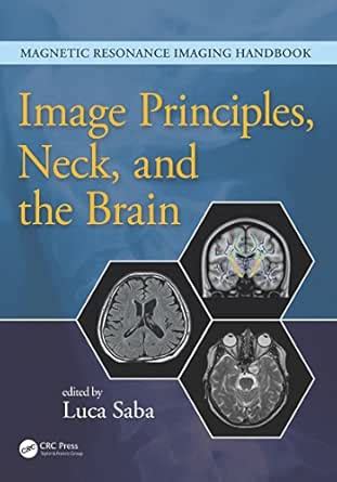 Image Principles, Neck, and the Brain eBook : Saba, Luca: Amazon.in ...