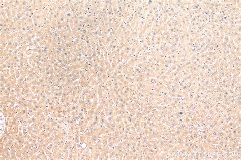 LC3 antibody (14600-1-AP) | Proteintech