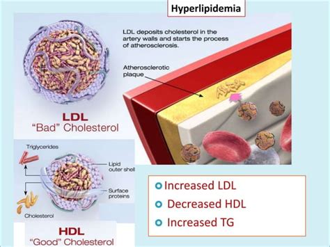 Image result for HDL Components Code