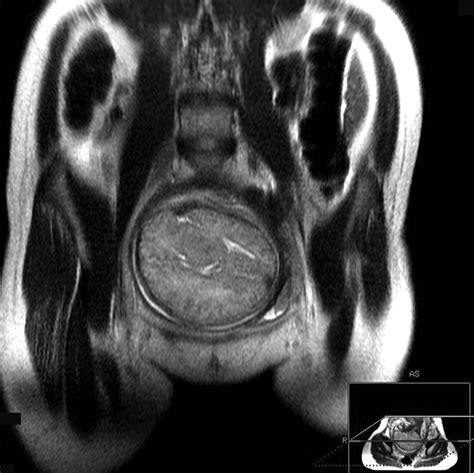 Comparison of Fetal Biometric Values with Sonographic and 3D ...