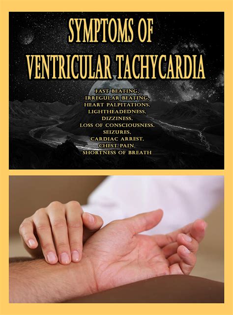 Buy Symptoms of Ventricular Tachycardia: Fast beating, Irregular ...