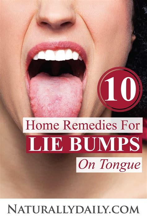 10 Proven Ways to Get Rid of Lie Bumps at Home