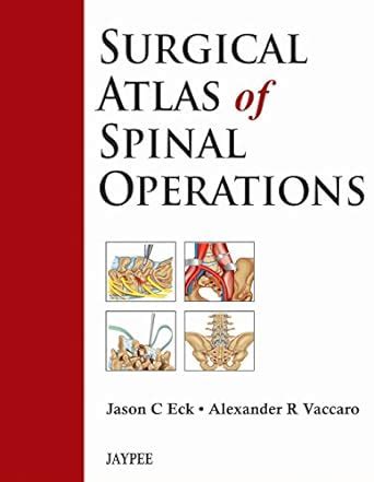 Surgical Atlas of Spinal Operations eBook : Eck, Jason C., Vaccaro ...