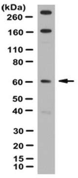 Anti-TTC8 Antibody from rabbit, purified by affinity chromatography ...