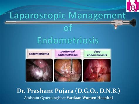 Laparoscopic management of endometriosis | PPTX